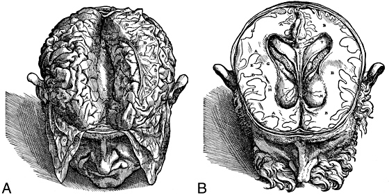 Vesalius brain dissection